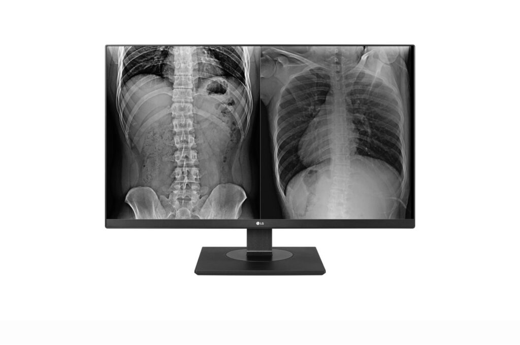 Monitor Medical LED IPS LG 27HJ713C-B.AEE 27″, 8MP, 4K UHD (3840×2160), DICOM, sRGB 99%, 350 cd/m2, 1000:1, HDMI x 2, DP x 1, USB 3.0, ajustare inaltime/Pivot
